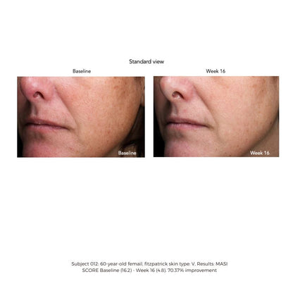 Senté Pigment & Tone Correcting Mask