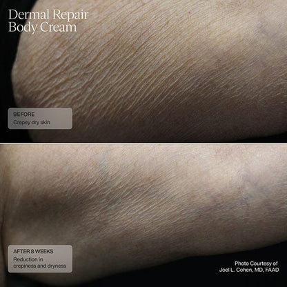 Senté Dermal Repair Body Cream