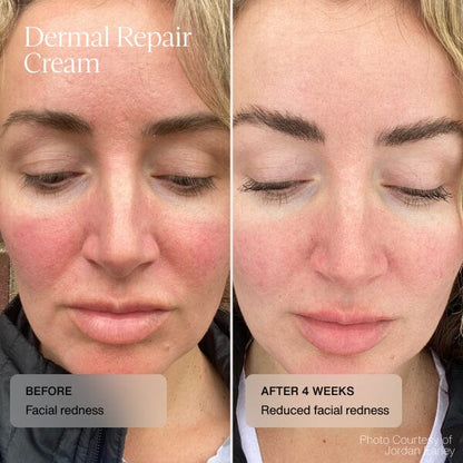 Senté Dermal Repair Cream