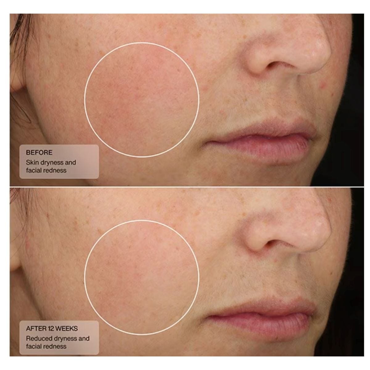 Senté Dermal Repair Ultra-Nourish Creme