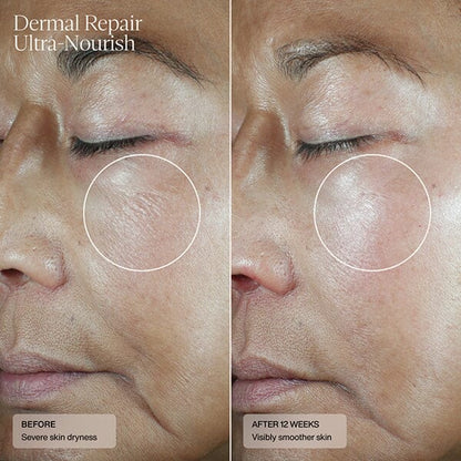 Senté Dermal Repair Ultra-Nourish Creme