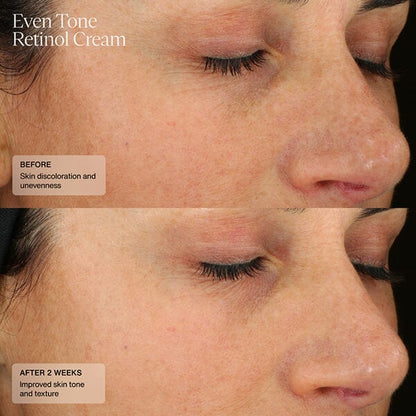 Senté Even Tone Retinol Cream