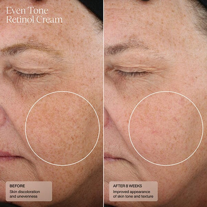 Senté Even Tone Retinol Cream