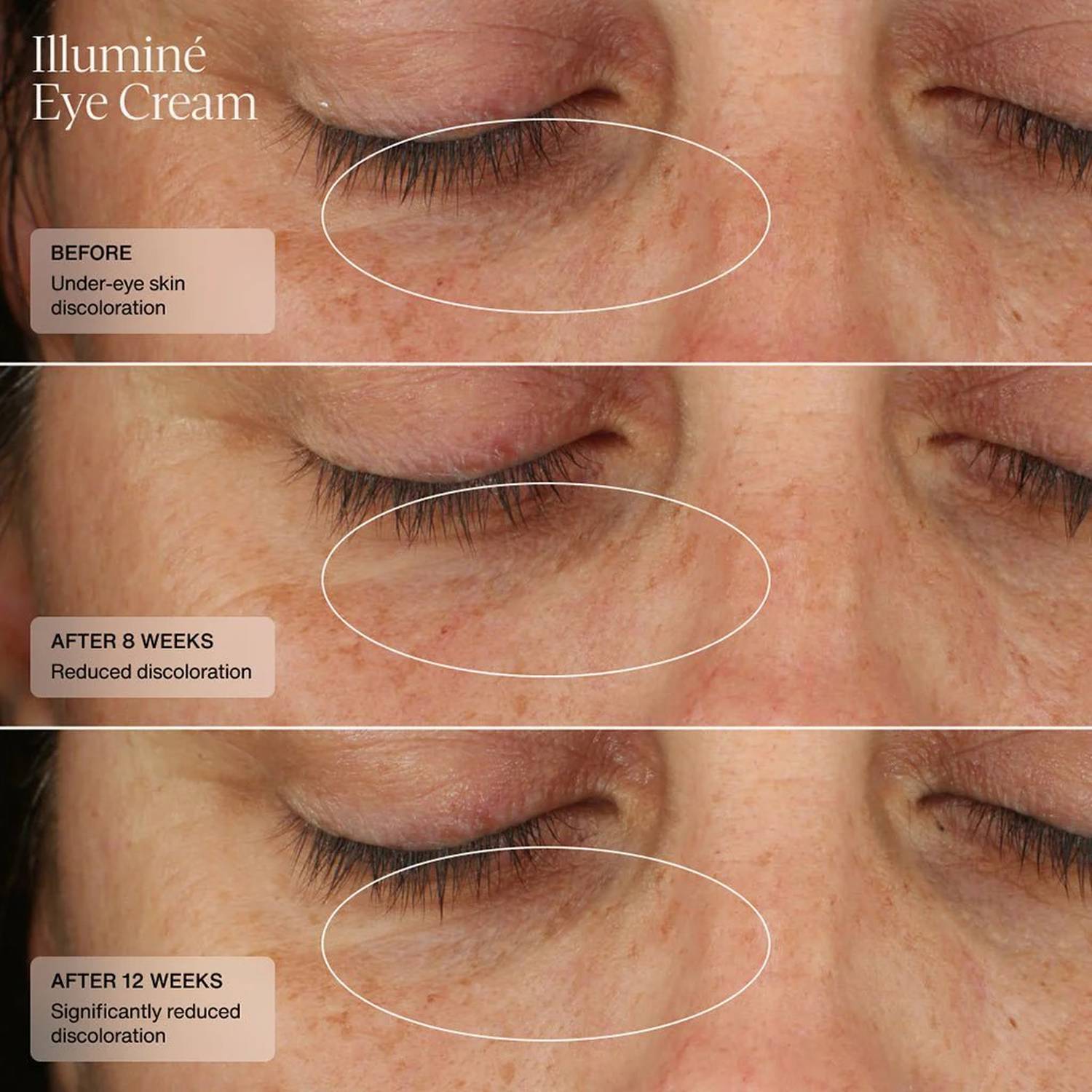 Senté Illumine Eye Cream