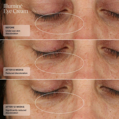 Senté Illumine Eye Cream
