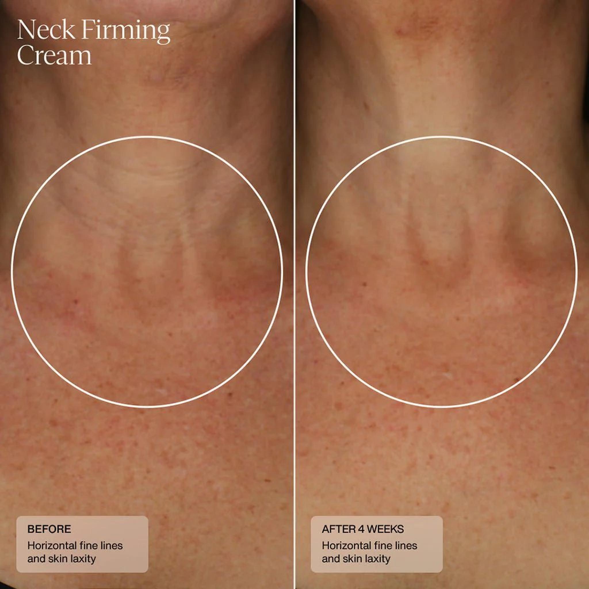 Senté Neck Firming Cream