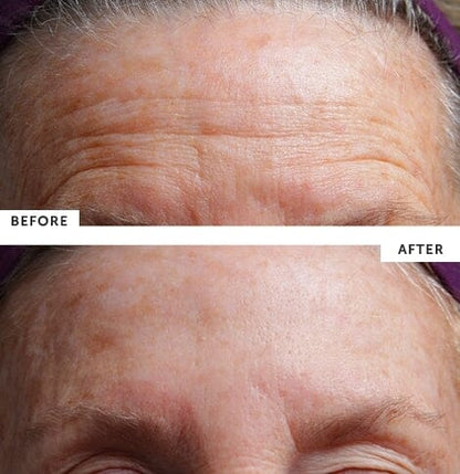 SilcSkin Facial Pads (Brow Set)