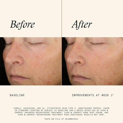 SkinMedica Even & Correct Brightening Treatment Pads