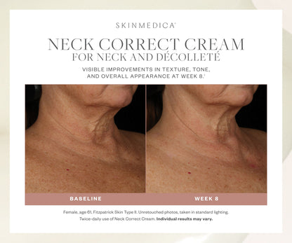 SkinMedica Neck Correct Cream for Neck and Decollete
