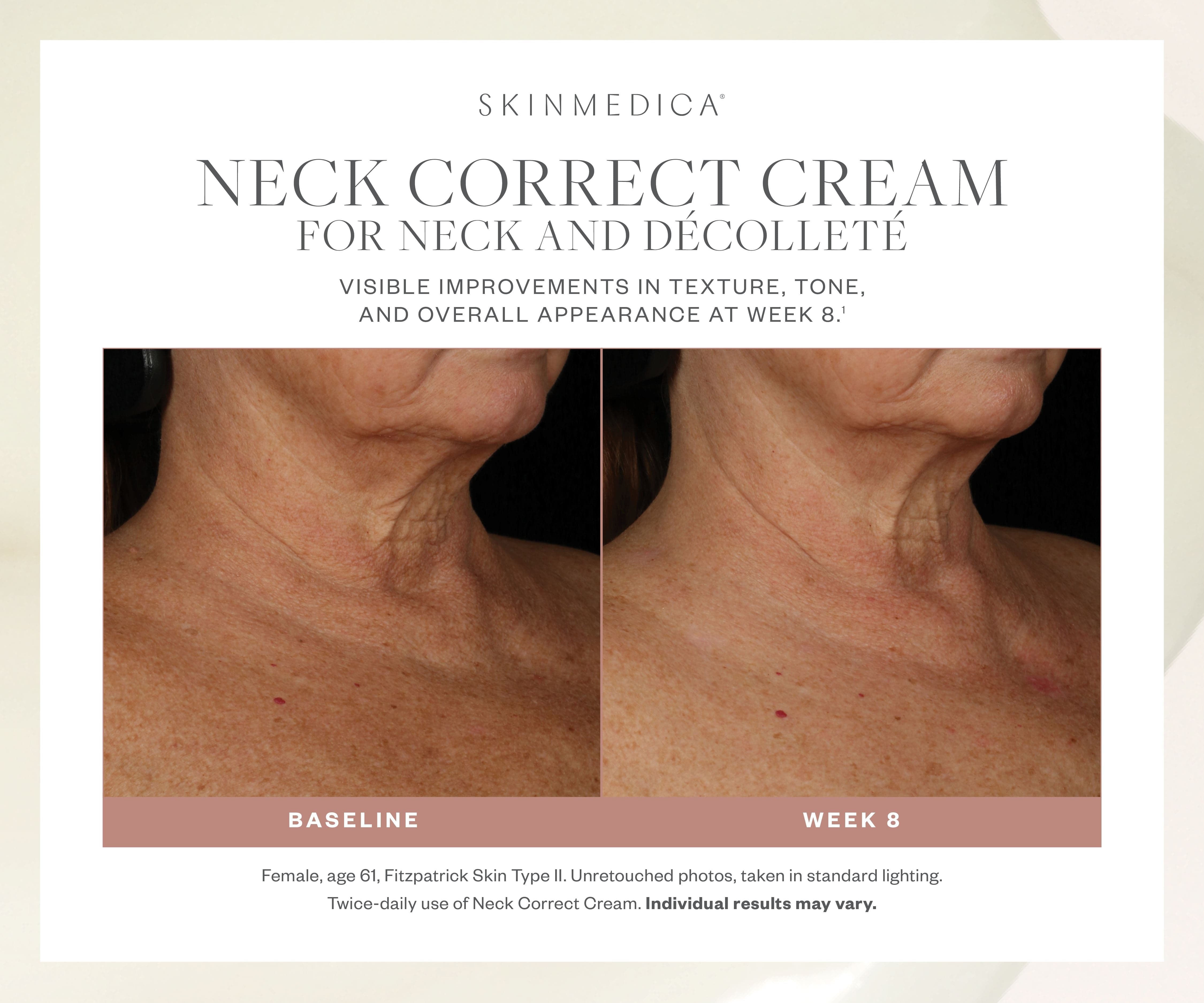 SkinMedica Neck Correct Cream for Neck and Decollete