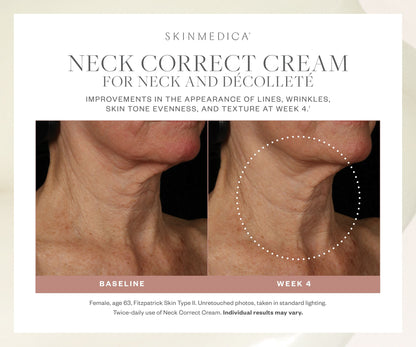 SkinMedica Neck Correct Cream for Neck and Decollete