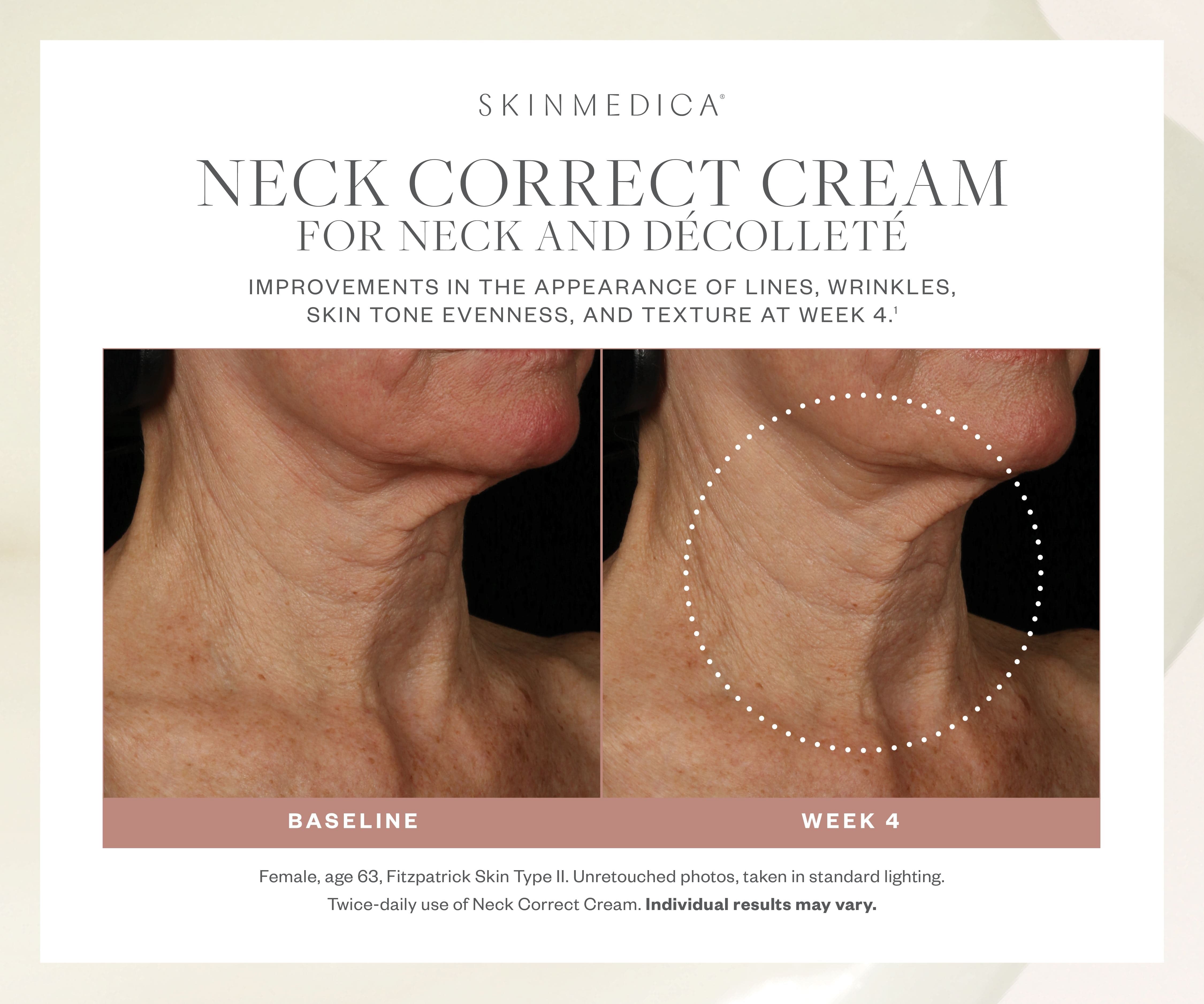 SkinMedica Neck Correct Cream for Neck and Decollete