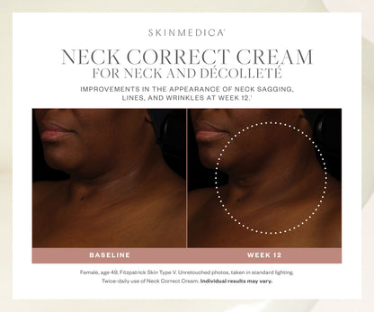 SkinMedica Neck Correct Cream for Neck and Decollete