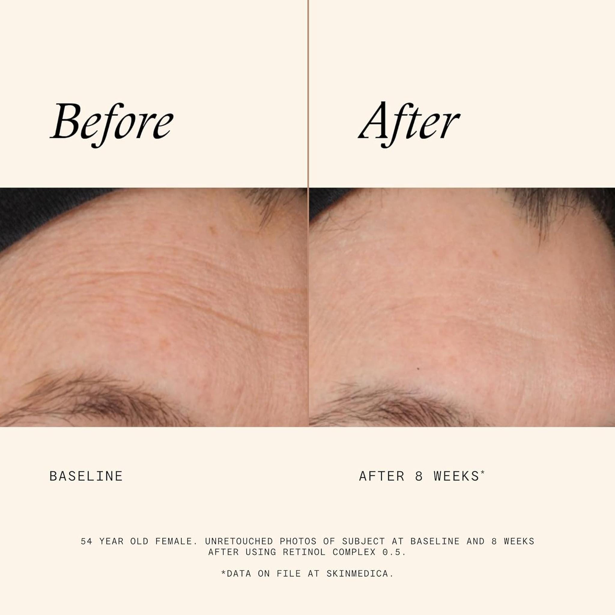 SkinMedica Retinol Complex 0.5
