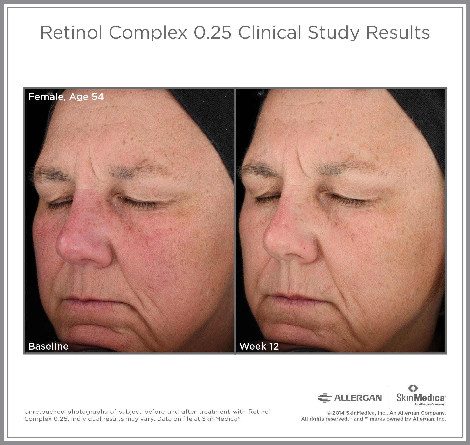 SkinMedica Retinol Complex 0.25