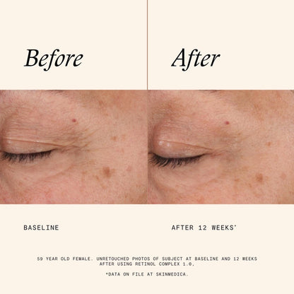 SkinMedica Age Defense Retinol Complex 1.0