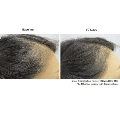Viviscal PRO Hair Growth Supplement - 9-Month Value Set