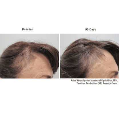 Viviscal PRO Hair Growth Supplement - 60 Tablets