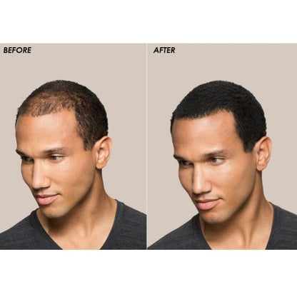 Toppik PRO Hair Building Fibers