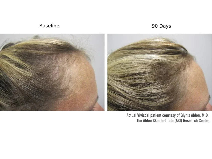 Viviscal PRO Hair Growth Supplement - 60 Tablets